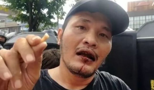  Nicho Silalahi: Hari Ini Saya Dianiaya Polisi