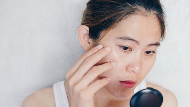 5 Kandungan Skincare yang Harus Dihindari Tipe Kulit Berminyak