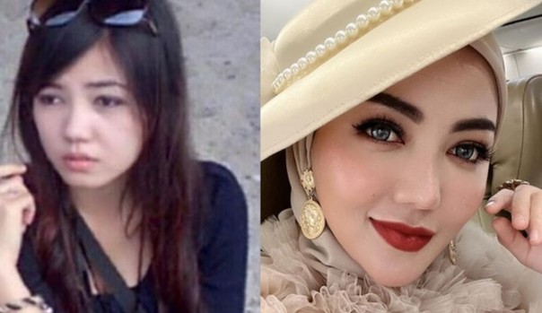 Hidung sampai Miss V, 7 Artis Indonesia Ini Rela Rogoh Kocek Dalam untuk Operasi Plastik