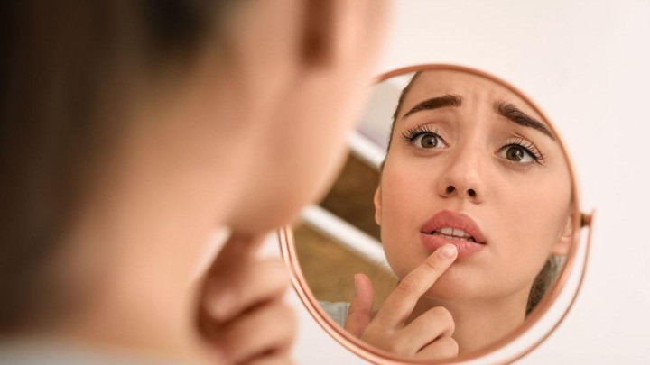 Benarkah Kebiasaan Menjilat Bibir Bisa Bikin Bibir Menghitam? Berikut Penjelasan dr. Kartika